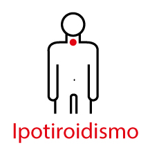 Ipotiroidismo e alimentazione